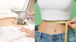 Laser vs Traditional Fat Reduction Methods: Key Differences